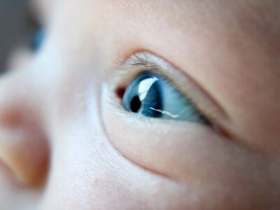 Signs of Eye and Vision Problems in Infants