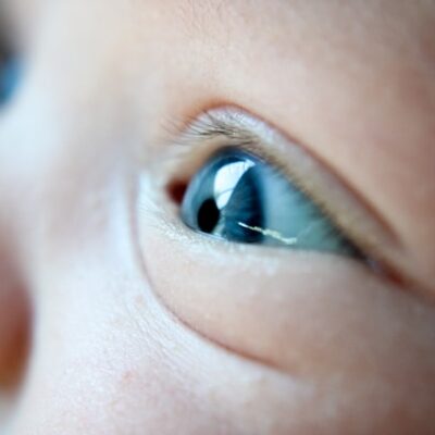 Signs of Eye and Vision Problems in Infants