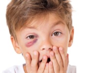Got a Shiner!