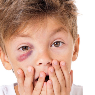 Got a Shiner!